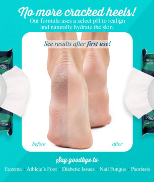 pHeet® Antifungal & Antibacterial Foot Wipes