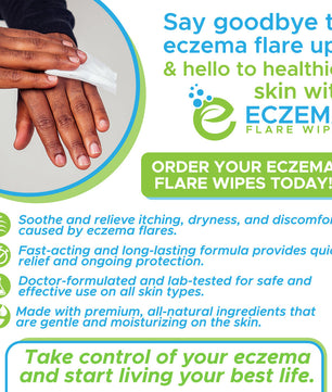 Eczema Flare Wipes®