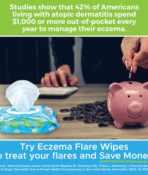 Eczema Flare Wipes®